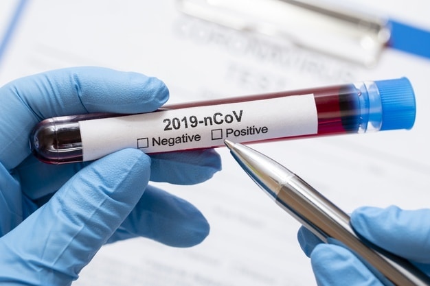 Włochy: od ośmiu tygodni pogarsza się epidemia koronawirusa