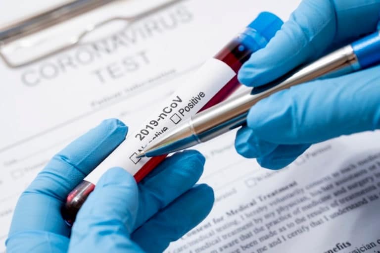 Niemcy masowo fałszują testy na obecność koronawirusa. Sprawę bada prokuratura