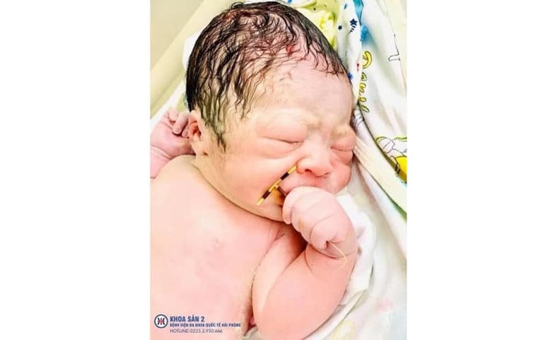 Zdjęcie lekarza podbija internet! Dziecko urodziło się trzymając w dłoni wkładkę antykoncepcyjną